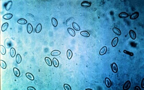 Telur cacing: foto di bawah mikroskop