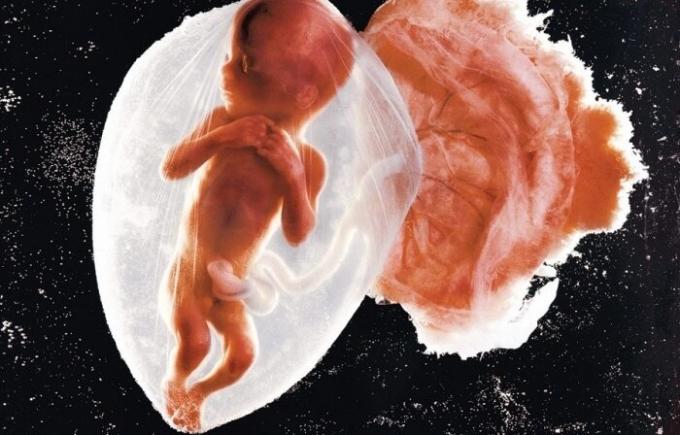 Foto pertama bayi embrio.